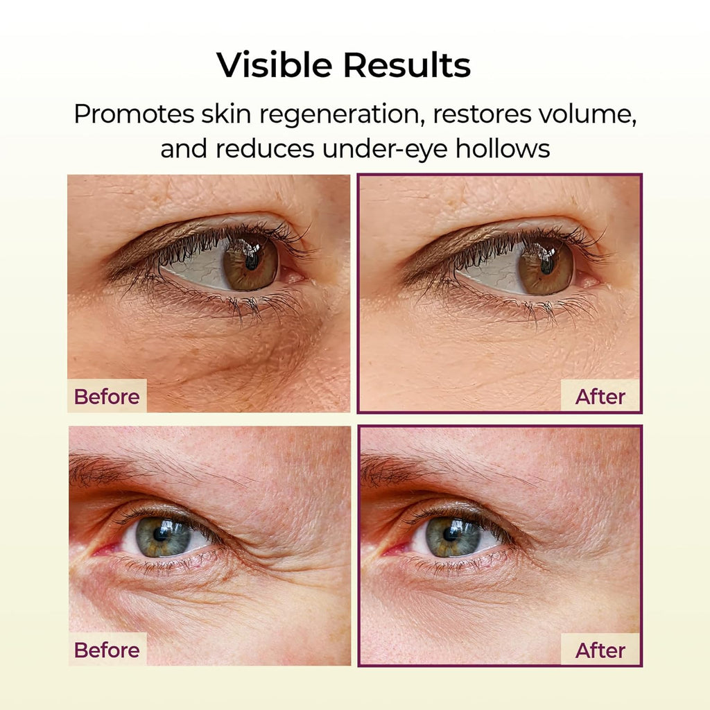 🔥 Collagen Revitalizing 5-Step Set, minimizes pores, includes a calcium-rich collagen cream