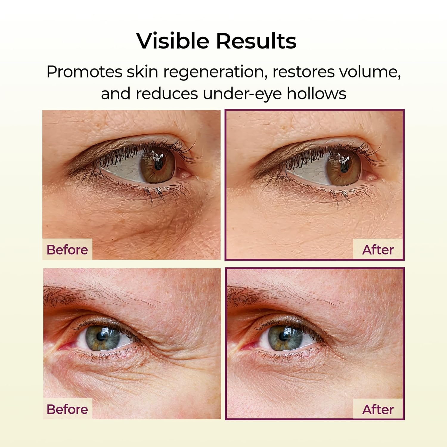 🔥 Collagen Revitalizing 5-Step Set, minimizes pores, includes a calcium-rich collagen cream